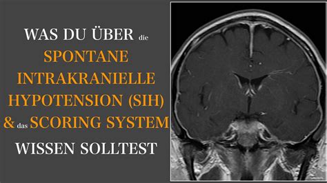 liquorverlustsyndrom symptome|Spontane Intrakranielle Hypotension